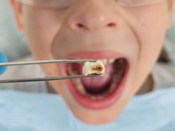 Best Emergency Dentist for Knocked-Out Tooth in Kittery Point, ME