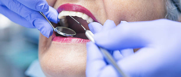 Best Emergency Dentist for Lost Fillings or Crowns in Kittery Point, ME